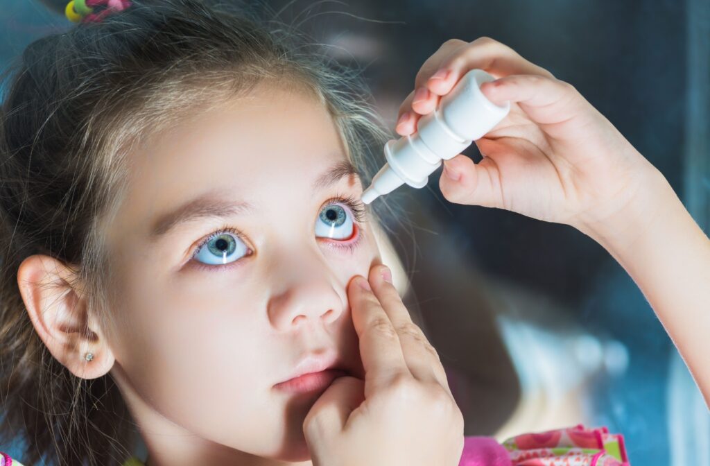 A young girl pulling her left lower eyelid down to apply atropine eyedrops to her left eye.