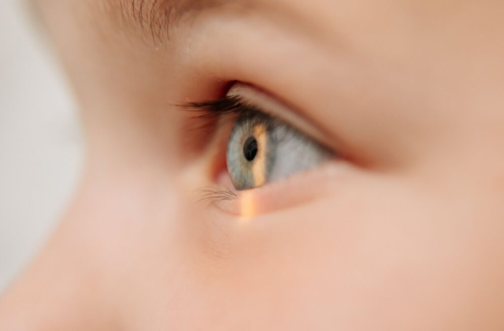 A close-up of a child's eye during an eye exam.